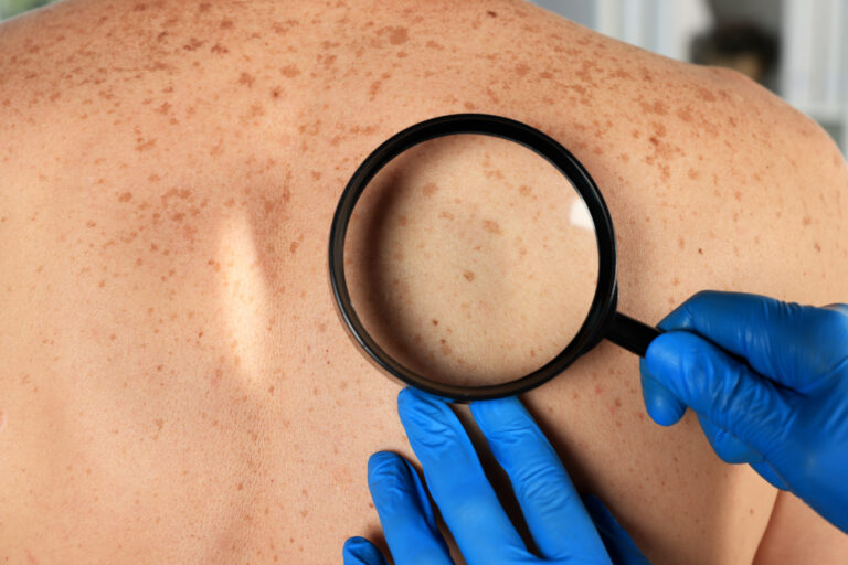 Tanning peptides – what is melanotan, how does it work, and what does research show?